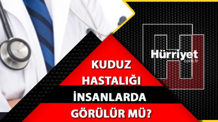 Kuduz insandan insana geçer mi, bulaşır mı Kuduz belirtileri nelerdir Kuduz hastalığı hakkında bilinmesi gerekenler