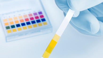 İdrar deyip geçmeyin birçok hastalığın habercisi olabilir... Hangi renk tehlikeli