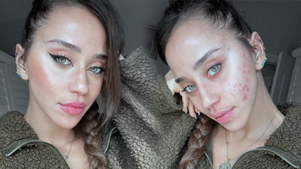 Özgüvenim sıfır demişti... Makyajsız fotoğraf geldi