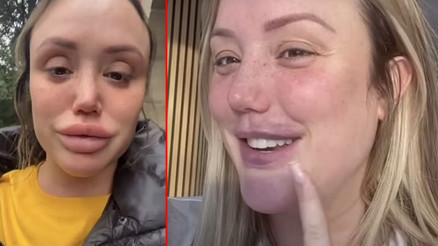 Estetik bağımlısı yıldız, sivri dilli yazarın kalemine düştü: Otomobil lastiği gibi