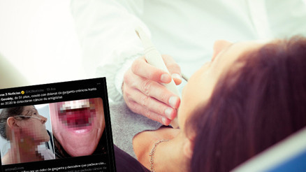 Bademcik iltihabı sandı kanser çıktı Yüzü ve boynunda yanıklar oluştu, konuşmakta bile zorlanıyor... Bademcik iltihabı sandı kanser çıktı Yüzü ve boynunda yanıklar oluştu, konuşmakta bile zorlanıyor...