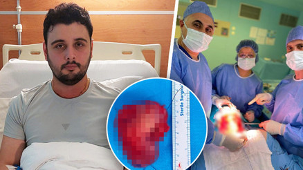 Kırık dişi hayatını kâbusa çevirdi: Yemek yiyemedi, konuşamadı... 29 yaşındaki gence dil kanseri şoku