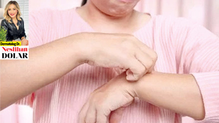 Dermatolog Dr. Neslihan Dolar yazdı: Sedef bulaşıcı değil