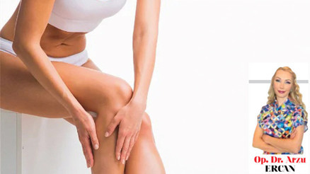 Op. Dr. Arzu ERCAN yazdı: Bacaklarımızda yıllar içinde büyüttüğümüz “varisler” ne kadar ileriye gidebilir Op. Dr. Arzu ERCAN yazdı: Bacaklarımızda yıllar içinde büyüttüğümüz “varisler” ne kadar ileriye gidebilir