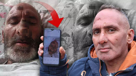 Sinek yüzünü tanınmayacak hale getirdi