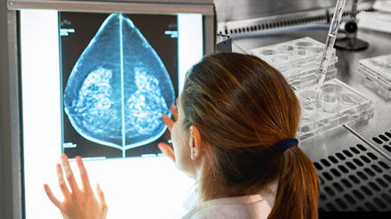 Meme kanseri aşısı ilk insan denemelerini geçti Neleri değiştirecek Düşüncesi bile heyecanlandırıyor