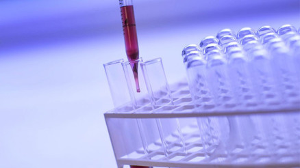 Op. Dr. Erman ÇEKİÇ yazdı: PRP tedavisi ne işe yarıyor Op. Dr. Erman ÇEKİÇ yazdı: PRP tedavisi ne işe yarıyor