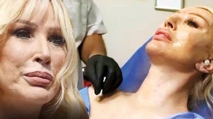 O anları sosyal medya hesabında paylaştı... Seda Sayana altın dokunuş estetiği