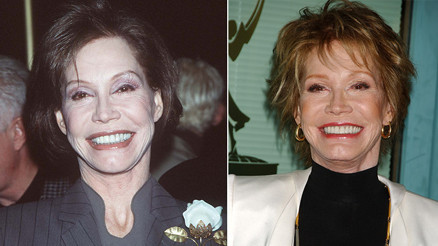 Acı gerçeği eşi anlattı: Ünlü oyuncu kör olduğunu yıllarca, hatta ölene kadar sakladı