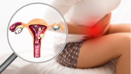 10 SORUDA ENDOMETRİOZİS DOSYASI | Dünyada ilk kez bilinen her endometriozis türünden doku üretildi 10 SORUDA ENDOMETRİOZİS DOSYASI | Dünyada ilk kez bilinen her endometriozis türünden doku üretildi