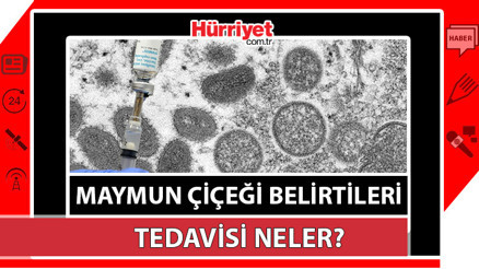 Maymun Çiçeği Virüsü belirtileri nelerdir, nasıl anlaşılır Maymun Çiçeği hastalığı tedavisi var mı, nasıl bulaşır Maymun Çiçeği Virüsü belirtileri nelerdir, nasıl anlaşılır Maymun Çiçeği hastalığı tedavisi var mı, nasıl bulaşır