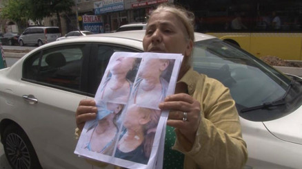 Diş tedavisine giden kadın kâbusu yaşadı... Narkoz sonrası yoğun bakıma alındı