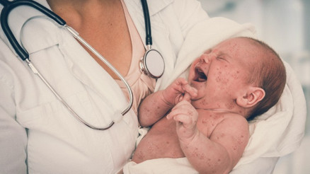 Çocuklardan sonra şimdi de yetişkinler kızamık riski altında... 10 soru 10 yanıt Çocuklardan sonra şimdi de yetişkinler kızamık riski altında... 10 soru 10 yanıt
