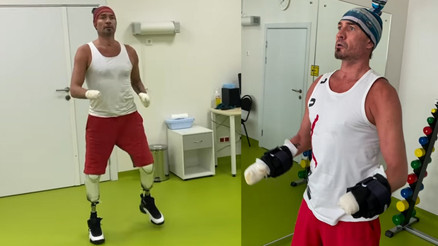 Şampiyon sporcunun trajedisi: Hem bacaklarını, hem ellerini kaybetti... Geriye içindeki umut kaldı