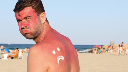 Güneş yanıklarına teslim olmayın