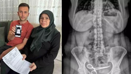 Gerçek röntgende ortaya çıktı 8 ay karnında yaşadı