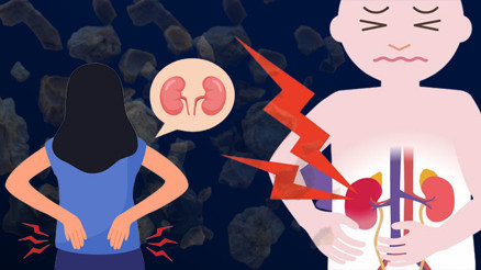 Böbrek taşı vakalarında korkutan artış ‘Sağlıklı insanlarda ve çocuklarda da görmeye başladık, bu endişe verici’