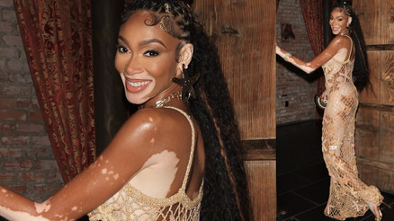 Herkesin alay ettiği günler geride kaldı: Hastalığı şansı oldu, hayatını değiştirdi