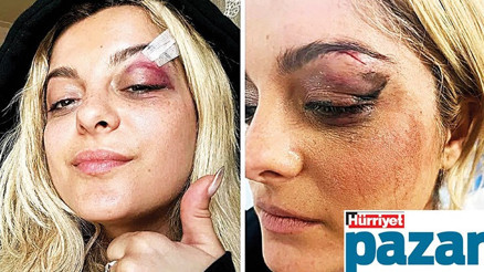 Cep telefonu fırlatan da var, peynir tekeri atan da…