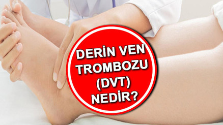 Derin ven trombozu (DVT) nedir, belirtileri nelerdir Ven trombozu tedavisi var mı İşte Derin ven trombozu hastalığı nedenleri