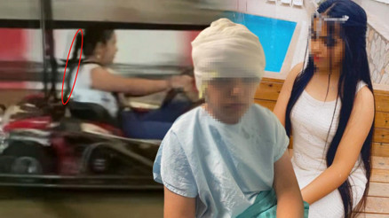 Go-kart pistinde facia Kız çocuğu ölümden döndü; saç derisi saatler süren ameliyatla dikildi Go-kart pistinde facia Kız çocuğu ölümden döndü; saç derisi saatler süren ameliyatla dikildi