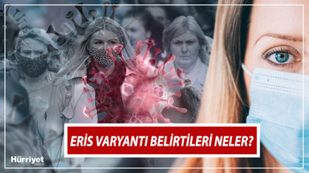 Eris varyantı nedir Eris varyantı (Eris virüsü) Türkiyede kaç kişide görüldü İşte Eris belirtileri ve semptomları
