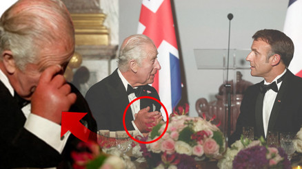 Fransa ziyaretine Kralın sosis parmakları damga vurdu İngiliz medyası doktorlara nedenini doktorlara sordu...