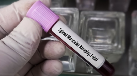 Ücretsiz SMA testleri hakkında merak edilen 12 soru 12 yanıt Ücretsiz SMA testleri hakkında merak edilen 12 soru 12 yanıt