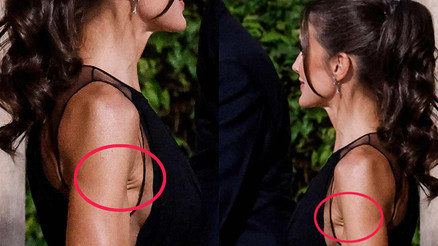 Yüzünü çektir, kaldır, gerdir... Ama bunun çaresi yok: Keşke ütü olsaydı Yüzünü çektir, kaldır, gerdir... Ama bunun çaresi yok: Keşke ütü olsaydı