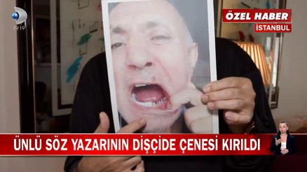 Ünlü söz yazarı Mehmet Yüzüakın dişçide çenesi kırıldı