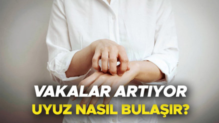 Uyuz belirtileri nelerdir, nasıl geçer ve bulaşır Uyuz hastalığı nedir Vakalarda yüzde 30 artış... Uzmanlardan uyuz uyarısı