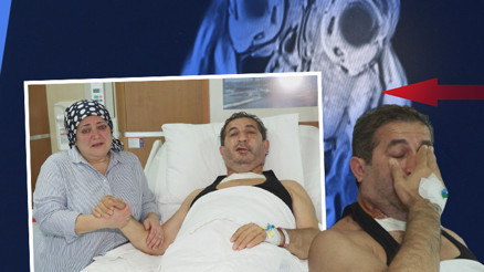 Yüzündeki sertliği fark edince korkunç gerçek ortaya çıktı: 1 ay daha gecikse gözünü kaybedecekti