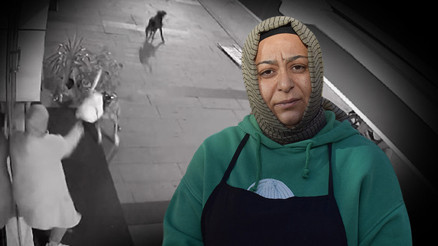Sakaryada iş yerinin önünde köpekler saldırdı Yaşadığı dehşeti anlattı Sakaryada iş yerinin önünde köpekler saldırdı Yaşadığı dehşeti anlattı