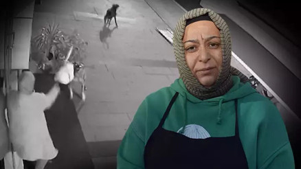 Sakaryada iş yerinin önünde köpekler saldırdı Yaşadığı dehşeti anlattı Sakaryada iş yerinin önünde köpekler saldırdı Yaşadığı dehşeti anlattı
