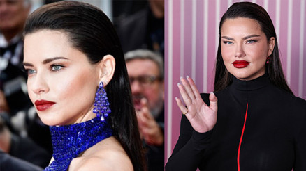 Ünlü modeli gören tanımakta zorlandı… ‘Senin güzel yüzüne ne oldu böyle’