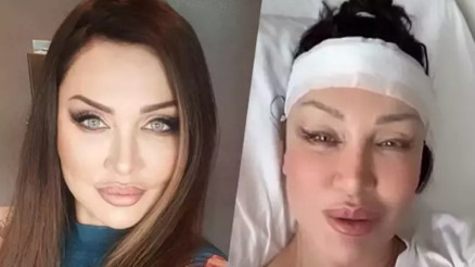 Umut Akyürek bıçak altına yattı: Alın daraltma ameliyatı geçirdim Umut Akyürek bıçak altına yattı: Alın daraltma ameliyatı geçirdim