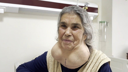 Doktordan korktuğu için 50 yıldır devasa kitleyle yaşadı Ameliyat sonrası ilk sözleri Korkulacak bir şey yokmuş oldu