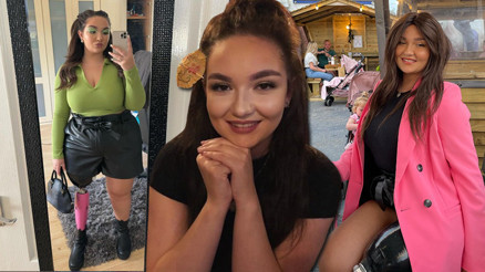 Yanlış teşhis yüzünden hayatı karardı Doktorların hizmetçi dizi dediği hastalık kanser çıktı... Genç kadının bacağı kesildi Yanlış teşhis yüzünden hayatı karardı Doktorların hizmetçi dizi dediği hastalık kanser çıktı... Genç kadının bacağı kesildi