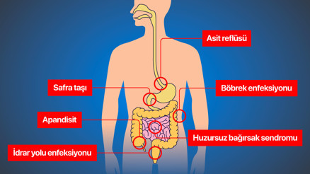 Karın ağrınızın yeri ne anlama geliyor İşte detay detay ağrı bölgeleri ve işaret ettikleri hastalıklar...