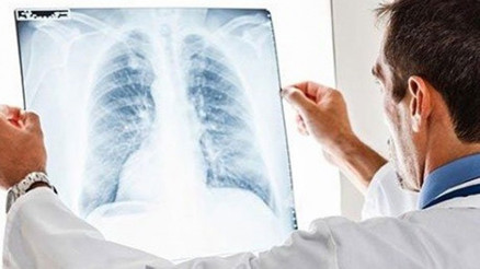 Zatürre belirtileri neler, nasıl bulaşır, hastalıktan nasıl korunabiliriz