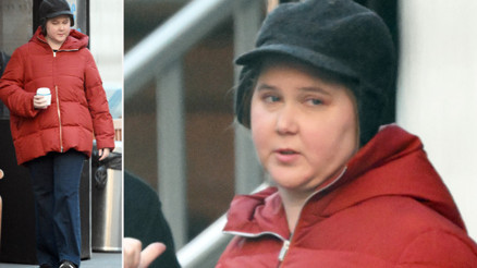 Herkes ünlü yıldızın yüzüyle alay etmişti: Altından ciddi bir hastalık çıktı