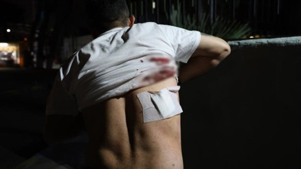 Yine taksi yine dehşet Aracımı kapattım yanıtını alınca sırtına makas sapladı Yine taksi yine dehşet Aracımı kapattım yanıtını alınca sırtına makas sapladı