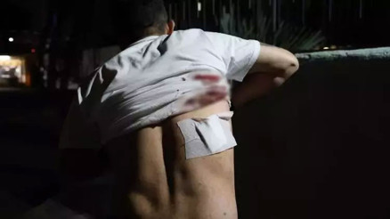 Taksiciden “Aracımı kapattım” cevabını alan yolcu, şoförün sırtına makas sapladı Taksiciden “Aracımı kapattım” cevabını alan yolcu, şoförün sırtına makas sapladı