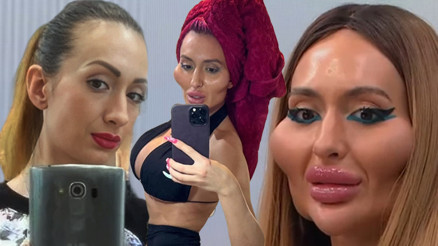 Anastasia Pokreshchuk: Estetik yaptırmak benim için kuaföre gitmek gibi