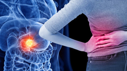 ‘Sessiz katil’ pankreas kanseri alarm veriyor 24 yaş altı kadınlarda yüzde 200 arttı Türkiye’de durum nasıl