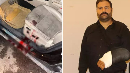 Antalyada avukata silahlı saldırı Mr. Oliverin dosyalarından çekil demedik mi