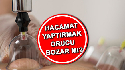 Hacamat orucu bozar mı Oruçluyken hacamat yaptırılır mı, olur mu Diyanet açıkladı Hacamat orucu bozar mı Oruçluyken hacamat yaptırılır mı, olur mu Diyanet açıkladı