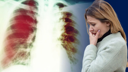 En ölümcül hastalık sessizce yayılıyor Testler negatif çıkmasına rağmen insanlar enfeksiyonu taşıyor…