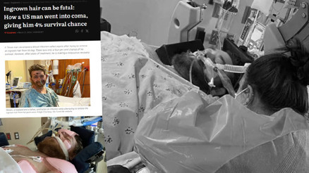 Bacağındaki kılları almaya çalışırken canından oluyordu Günlerce komada kaldı, doktorlar yaşaması için yüzde 4 şans verdi