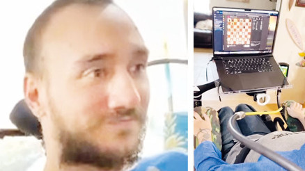 Düşünce gücüyle satranç oynadı Beyin çipi felçli hastalar için umut olacak